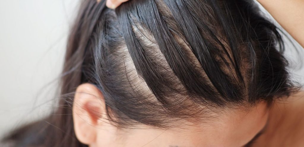 Cheveux fins et clairsemés : l'astuce make-up bluffante pour camoufler le  manque de densité quand